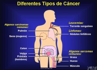 Un tercio de la población tendrá cáncer a lo largo de su vida