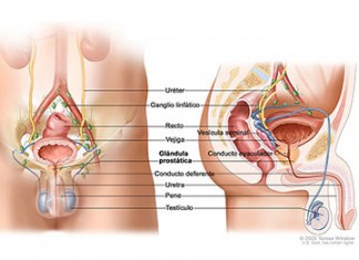 La terapia hormonal contra el cáncer de próstata puede aumentar el riesgo de depresión