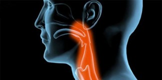 garganta dolor asfixia