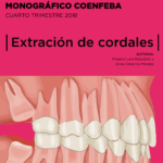 4-2018 Extracción de cordales
