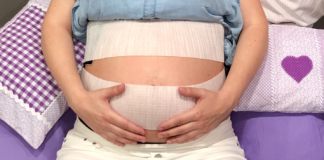 Tres matronas patentan un cinturón desechable para la monitorización materno-fetal