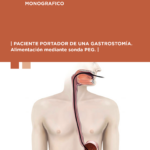 2022-1 Paciente portador de una gastrostomía. Alimentación mediante sonda PEG