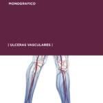 2022-2 Úlceras vasculares-1