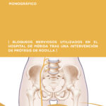 Bloqueos_nerviosos.indd